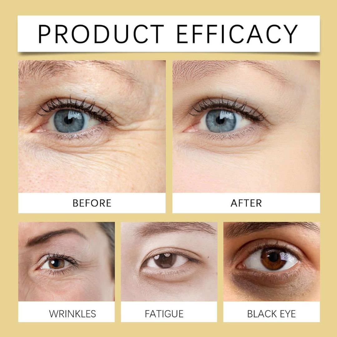 CastorLift™ Eye Roll-On