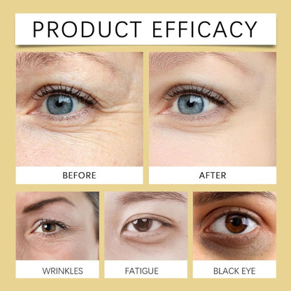 CastorLift™ Eye Roll-On