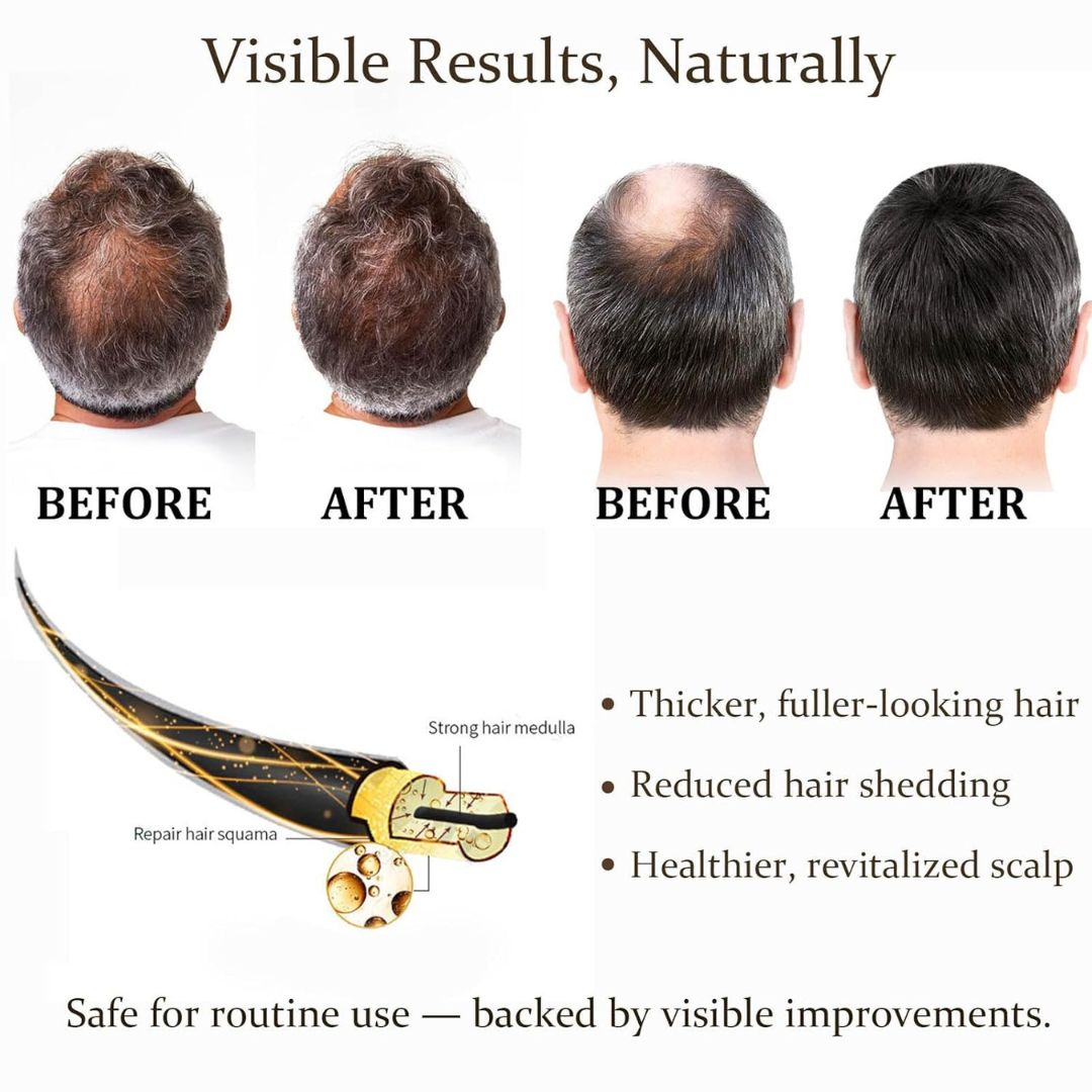 FollicleBoost™ Micro-Roller Serum