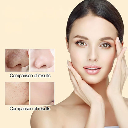 FreshZing™ Skin Buff Gel