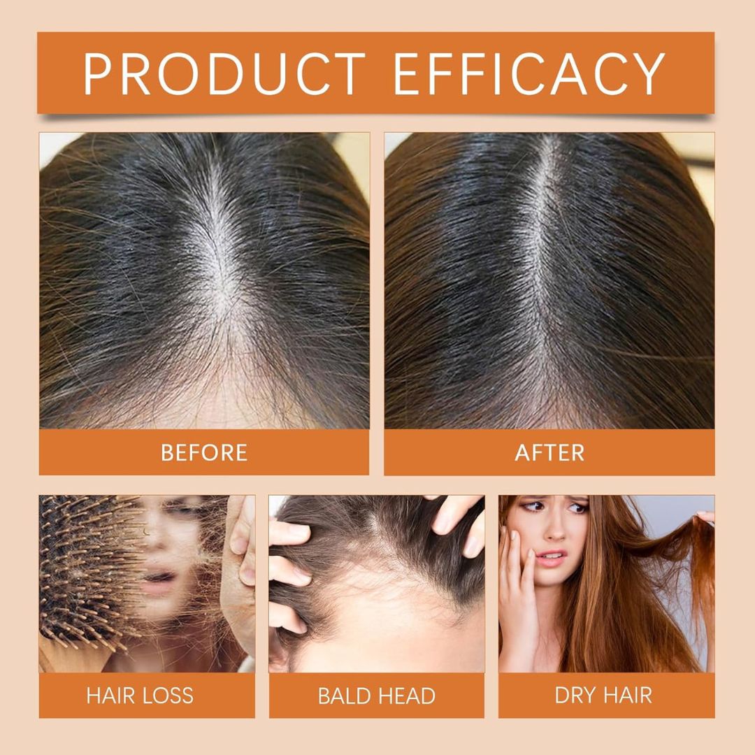 RootForge™ Hair Ampoules
