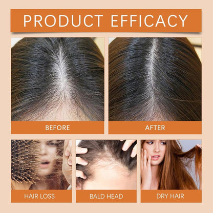 RootForge™ Hair Ampoules